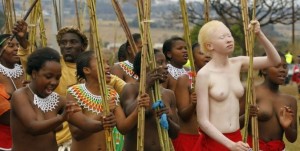 il-destino-degli-albini-africani-orig_main